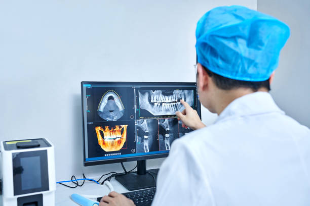 Best Emergency Wisdom Teeth Removal in Bellville, OH